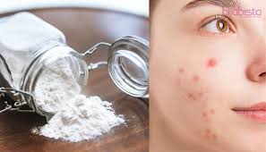 Selain untuk membuat kue, baking soda juga sering digunakan untuk perawatan kecantikan kulit, namun jangan terlalu sering. Kegunaan Baking Soda Dalam Rutin Penjagaan Kulit Cukup Mengagumkan Hilangkan Jerawat Hijabista