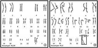 Exploring Contemporary Issues In Genetics Society Karyotyping Biological Sex Gender