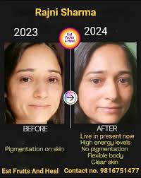 Fruitarian diet for lifestyle disorders