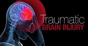 The destruction caused by brain injuries in car accidents is a surprise to no one. Car Accidents Can Cause Traumatic Brain Injuries Miami Car Accident Lawyer