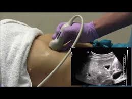Pelvic ultrasound may be used for evaluation of female pelvic organs. How I Do It Ultrasound Of The Abdomen Youtube