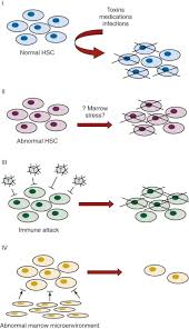 Patients with pure red cell aplasia commonly exhibit symptoms of anemia. Acquired Aplastic Anemia And Pure Red Cell Aplasia Oncohema Key