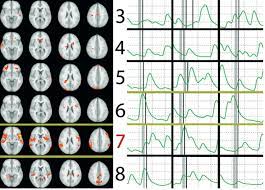 A lie detector machine is not accurate in detecting lies, just in measuring reactions. Brain Scan Better Than Polygraph In Spotting Lies Kurzweil