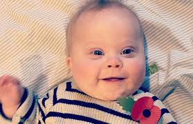 طفل مصاب بمتلازمة داون يستحم بطعامه يتحول لنجم ووالدته سعيدة بتفاعل الناس معه فيديو بوابة الأهرام