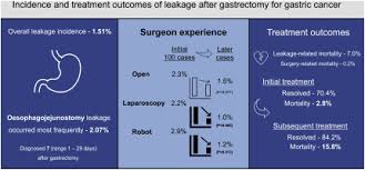 Stomach cancer cells can spread by breaking away from the original tumor. Incidence And Treatment Outcomes Of Leakage After Gastrectomy For Gastric Cancer Experience Of 14 075 Patients From A Large Volume Centre Sciencedirect