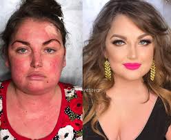 16 Before And Afters Showing The Power Of Makeup Makeup Transformation Skin Care Dark Spots Contour Makeup