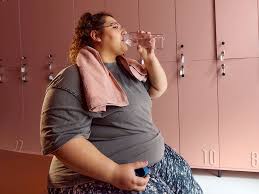 Image result for Obesity