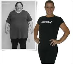 bobbie gastric byp weight loss