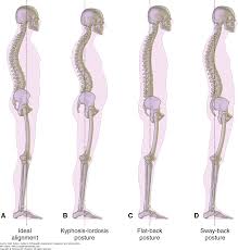 Gait And Posture Analysis Duttons Orthopaedic Examination