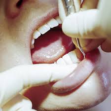 Many different issues can cause a swollen gum around one tooth, including periodontal disease or a dental abscess. All Gum Disease Treatments Have The Same Goal Removing Bacterial Plaque Mountain View Dental