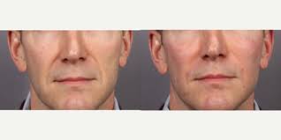 Alissandro (Andy) Castillo, MD, MBA, Physician