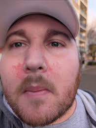 What doctor or specialist gave you the bad news of Fibromyalgia?