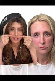 Ddr Morse Mia Esthetic Austin