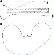 a 6 inch 3 0 v loc suture on a v 20 needle 26 mm tapered