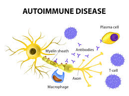 Autoimmune disease refers to illness or disorder that occurs when healthy tissue (cells) get destroyed by the body's own immune system. Triggers Of Autoimmune Disease Naturopathic Doctor News And Review