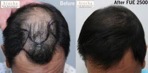 In fact, your hair creates oil for a reason. Ethnic Hair Restoration Treatment Dallas L San Antonio