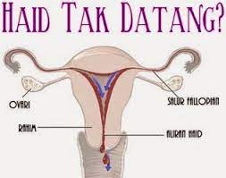 Apakah punca lambat datang haid? Dua Tahun Tak Datang Period Akhirnya Normal Dengan Vivix Cara Hidup Sihat