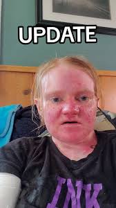 Stoney Creek HR Discrimination Update