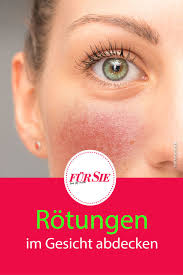 Tragen sie die maske anschließend auf ihr gesicht auf. Die Besten Make Up Tipps Bei Rotungen Im Gesicht Rotungen Im Gesicht Gesicht Rotungen