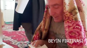 Dogal Goz Tedavisi Kurt Dokme Youtube