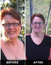 Weight Loss Success Stories