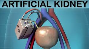 Artificial Kidney Transplant Cost In Pakistan Low Cost Artificial Kidney Transplant Pakistan