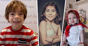 La Historia De Superacion De 3 Pequenos Con Enfermedades Raras