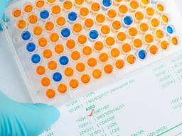 Home Hiv Test Kits Types Effectiveness Cost And What To Expect