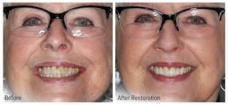 Great Lafayette Sedation Dentist