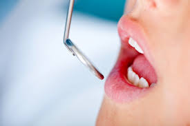 Oral cancer, also known as mouth cancer, is cancer of the lining of the lips, mouth, or upper throat. Oral Cancer Screenings In Irving Irving Family Dental