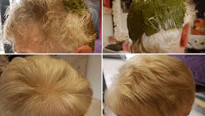 Pharma gdd vous propose sa sélection de coloration cheveux pour vous permettre de changer de couleur de cheveux comme bon vous semble ou pour vous aider à couvrir vos cheveux blancs. Pi5ioqgqbpyjym