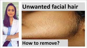 It is typically a secondary sex characteristic of human males. How To Remove Facial Hair Unwanted Facial Hair Causes Treatment Dermatologist Dr Aanchal Panth Youtube