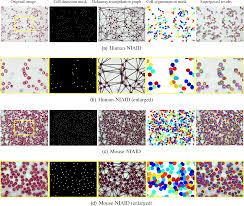 Falciparum, with 75 to 85 percent of red blood cells containing one to five parasites per cell. Malaria Parasite Detection And Cell Counting For Human And Mouse Using Thin Blood Smear Microscopy
