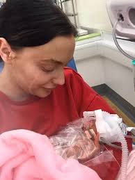 Tiny premature baby with skin so thin she was kept in a 'bag' defies odds  of survival
