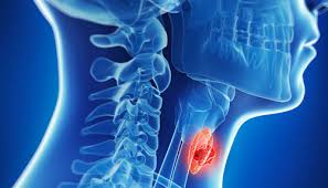 A procedure that makes a series of detailed pictures of areas inside the body, taken from different. Head Neck Cancer Symptoms The Symptoms Of Mou Sun Cancer Hospital