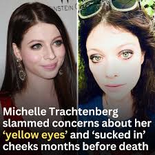 Full story:  https://news.meaww.com/michelle-trachtenberg-slammed-concerns-about-yellow-eyes-and-sucked-in-cheeks-months-before-her-death?utm_source=throwbacks&utm_medium=photo