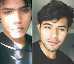 Dalam mimpi, emas merupakan unsur yang tidak disukai, menyebabkan kerusakan, kecemasan dan mimpi mendapatkan emas, berarti mendapatkan susah atau sesuatu yang tidak disukai atau mimpi menemukan uang dinar emas , sebelah muka ada tulisan nama allah dan sisi muka yang satu. Perubahan Wajah 7 Selebriti Dahulu Dan Kini Mohon Jangan Gelak Iluminasi