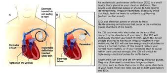 Implantable cardioverter defibrillator (icd), and how they differ from brady pacemakers. What Is Difference Between Icd And Pacemaker
