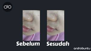 Begini cara menghilangkan jerawat dengan metode alami. Cara Menghilangkan Jerawat Di Foto Menggunakan Android