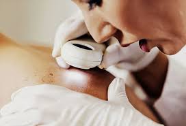 Cancer Symptoms Skin Spots Weight Loss Fatigue And More