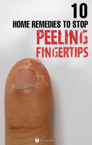 10 Home Remedies To Treat Peeling Fingertips It Makes Things Pretty Inconvenient Having Peeling In 2020 Peeling Fingertips Dry Skin Remedies Home Remedies For Skin