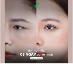Đôi mắt đẹp - Thu hút mọi ánh nhìn