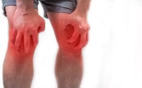 There are many things can go wrong in the knee. Swollen Stiff Knees After Basketball Hurt When Bending Scary Symptoms