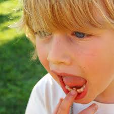 If a tooth is extremely loose, a splint can be used to hold it in place. Your Child S First Loose Tooth