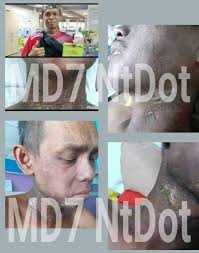 Sedihnya apabila lihat orang tersayang 'down' kerana perkara ini. Kanser Tahap 4 Kini Pulih Ntdot Malaysia Super Foods Facebook