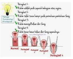 Ini adalah fase lanjut yang harus dilakukan jika anda merasa bahwa sang perempuan sudah mulai jatuh hati pada anda. Cara Kesan Peranakan Jatuh Urutan Tradisional Kuching Facebook