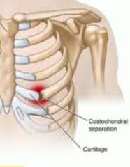 Athletic Injuries Abdominal Thoracic Injuries Flashcards Cram Com