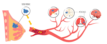 Comprendre - Association OSE