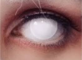 White Contact Lenses Google Search Contact Lenses White Out Contacts White Contact Lenses