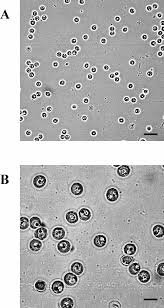 Cryptosporidium parvum is one of several species that cause cryptosporidiosis, a parasitic disease of the mammalian intestinal tract. Light Microscopic Image Of Cryptosporidium Parvum Oocysts Purified From Download Scientific Diagram